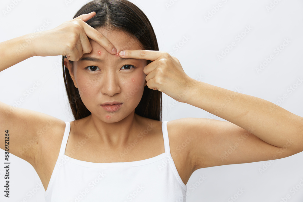 Asian woman facial skin problems, acne and inflammation, red rashes and allergies, chicken pox, sadness from rashes. Facial skin care concept for diseases and nerves Asian woman facial skin problems, acne and inflammation, red rashes and allergies, chicken pox, sadness from rashes. Facial skin care concept for diseases and nerves