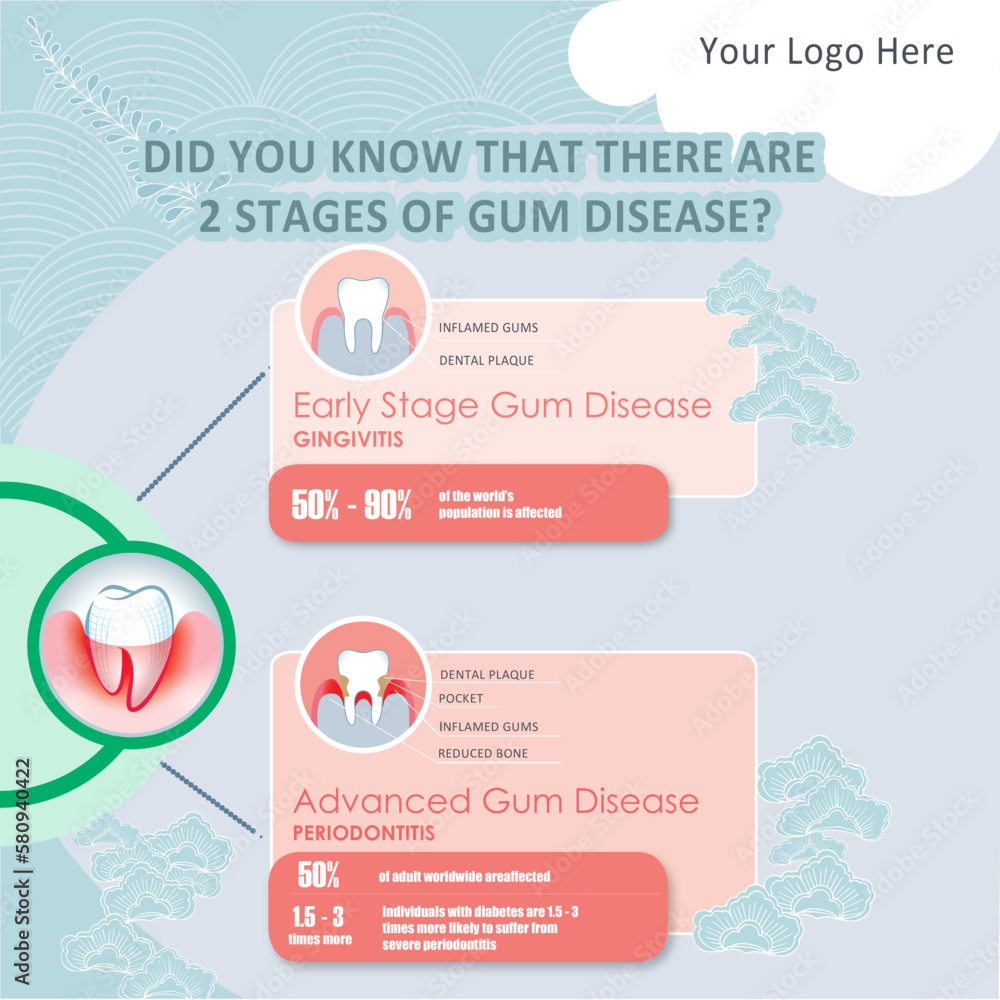 infographics options banner Gum Disease Stock Vector Adobe Stock
