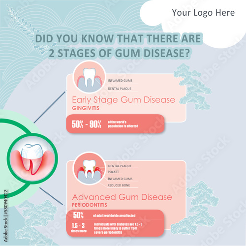 infographics options banner Gum Disease