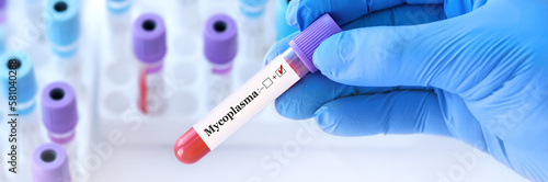 Doctor holding a test blood sample tube positive with Mycoplasma test on the background of medical test tubes with analyzes.Banner.