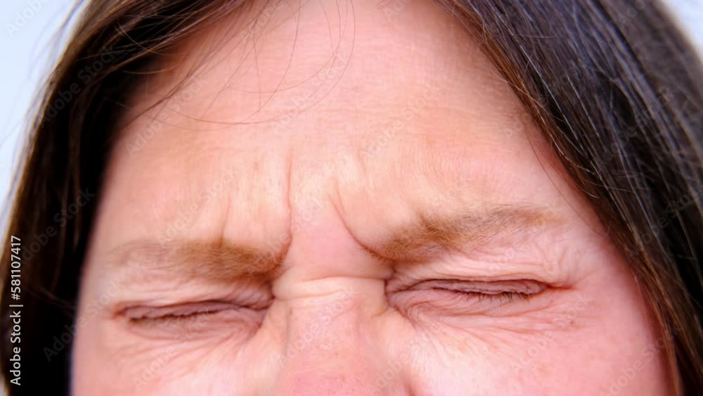 close up part of mature female face, woman 50-55 years old, tired eyes, allergies, deep wrinkles, age-related skin changes, wrinkles around eyes, overhang, concept of cosmetic anti-aging procedures close up part of mature female face, woman 50-55 years old, tired eyes, allergies, deep wrinkles, age-related skin changes, wrinkles around eyes, overhang, concept of cosmetic anti-aging procedures