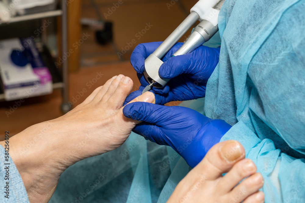 Podiatrist works carefully on her patient's toenails with a medical