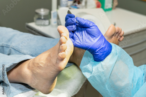 Podiatrist about to begin removing dry skin from the sole of a patient's foot. Podiatrist attending to her patient. High quality photo