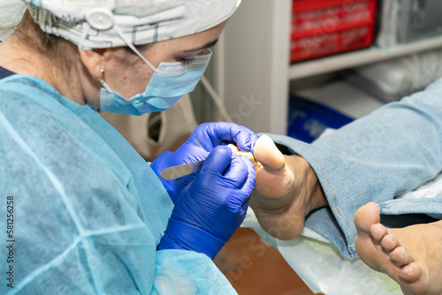 Podiatrist carefully cleans her patient's toenails. Nail treatment. Podiatrist attending to her patient. High quality photo