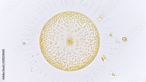 Gossleriella sp, marine phytoplankton from diatom group. Lugol preserved sample. Selective focus photo