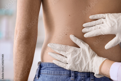 Dermatologist examining mole on young man's back in clinic, closeup photo