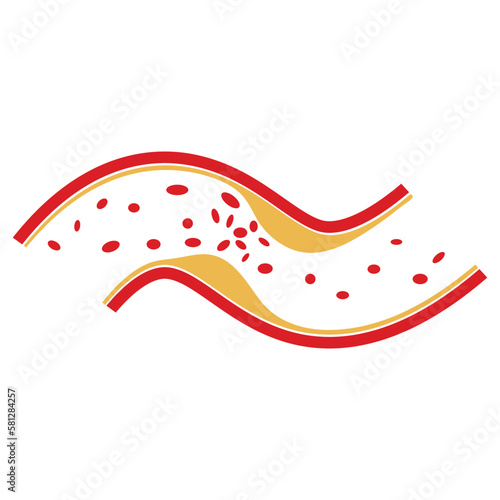 vector of cholesterol plaque