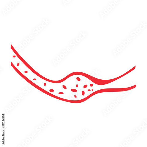 vector of cholesterol plaque