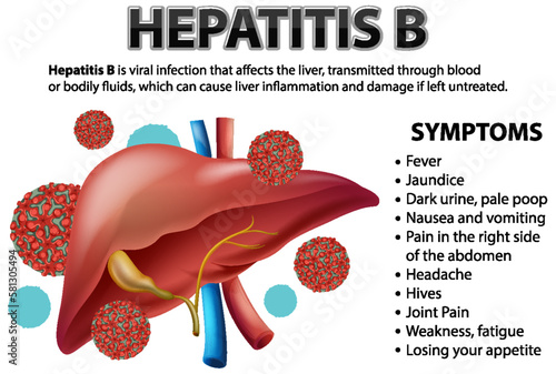 Symptoms of Hepatistis B