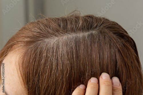 Close up head with gray hair on roots along hair parting before coloring