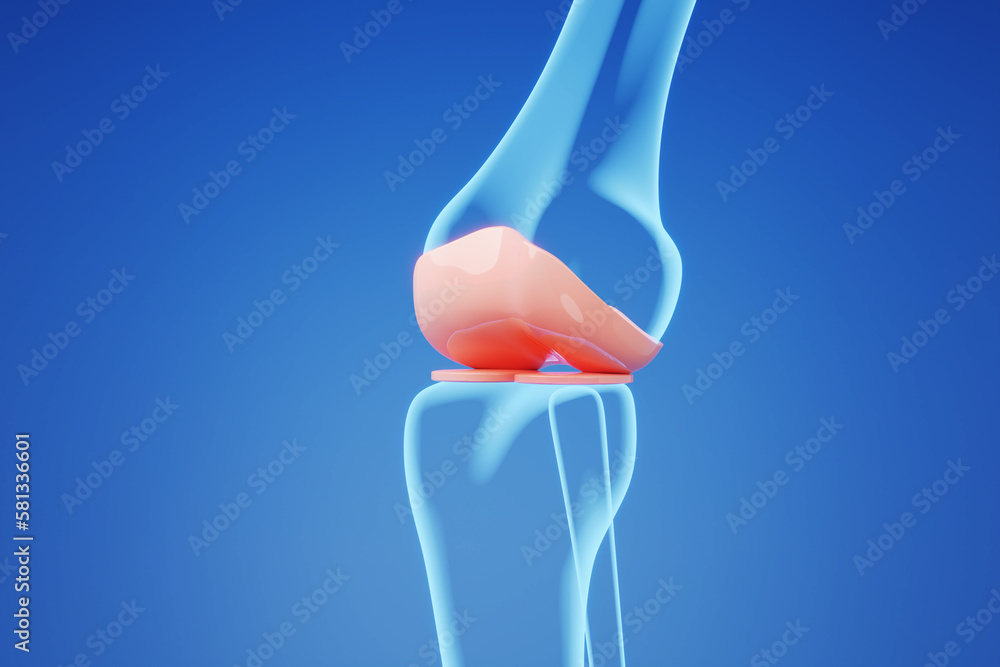 X ray Bone of knee and joint on blue background for medical and knee ...