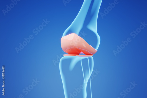 X ray Bone of knee and joint on blue background for medical and knee treatment concept. 3D rendering. photo