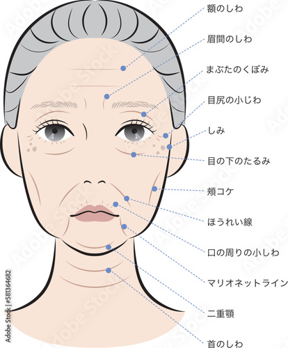 老化が進んだ女性の顔