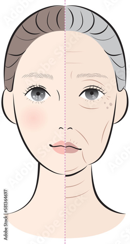 若い女性と老化が進んだ女性の顔の比較