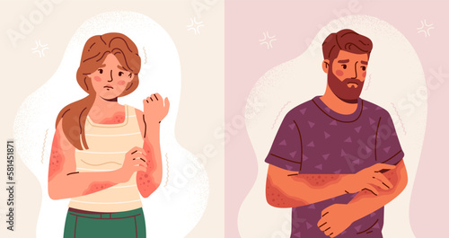 People with skin diseases. Set of characters with acne, dermatitis, eczema or psoriasis on body. Man and woman treat dermis for inflammation and redness. Cartoon flat vector illustration collection