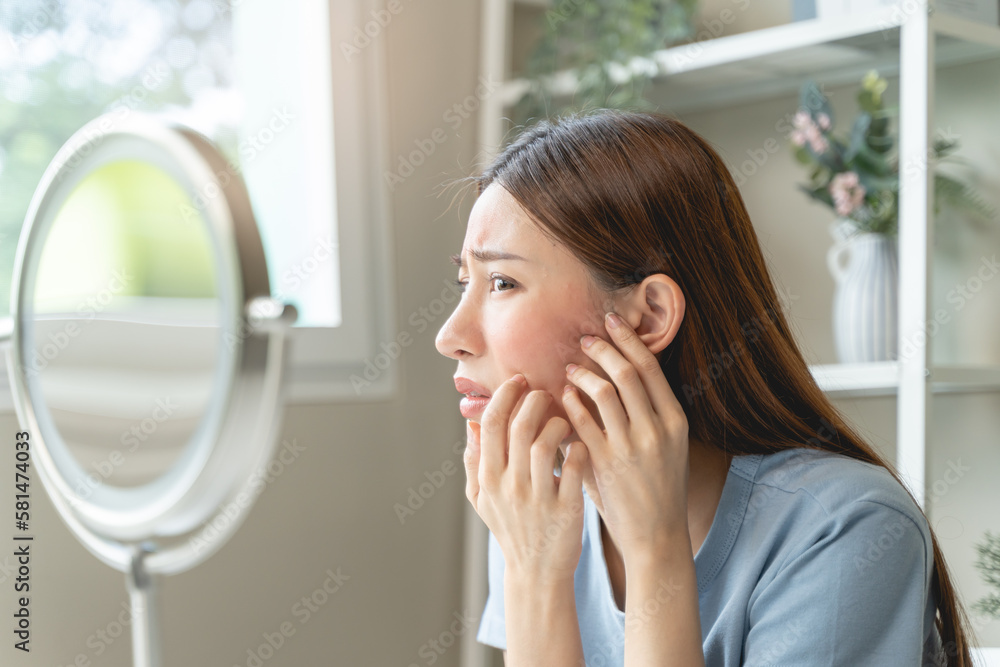 Sensitive skin with cosmetology, Asian young woman looking at red spot on her face from cosmetic allergy in the mirror. Sensitive skin with cosmetology, Asian young woman looking at red spot on her face from cosmetic allergy in the mirror.