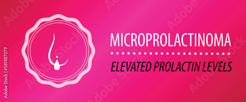 Microprolactinemia elevated prolactin design illustration