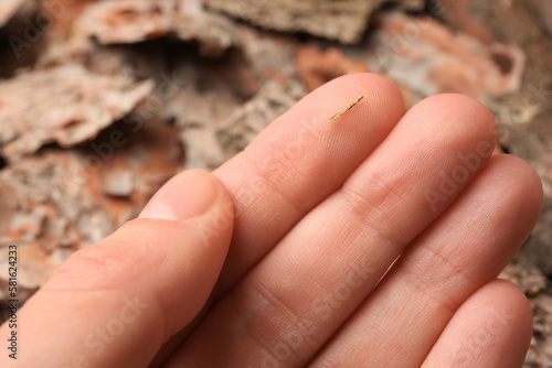 Woman with splinter in her finger on blurred background, closeup photo