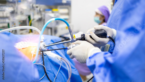 Doctor or Surgeon did laparoscopic or endoscopic minimal invasive surgery inside operating room in hospital.People hold medical instrument arthroscopic orthopedic surgery in blue uniform with light.