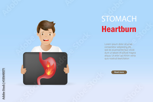 Man holding x ray film with heartburn stomach, gerd, gastric ulcers. Digestive disorder causes patient heartburn pain or acid reflux indigestion. Medical and healthcare. 