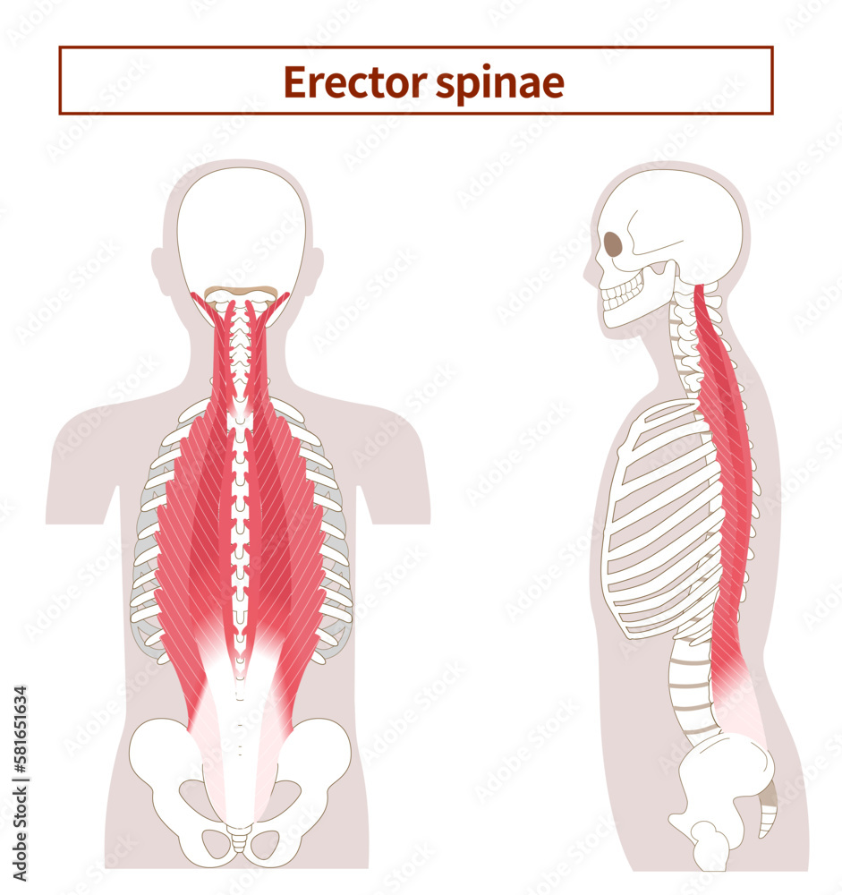 Illustration of the anatomy of the erector spinae muscle from the side