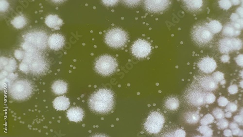 growth of any bacteria in a petri dish for the analysis of intestinal microflora