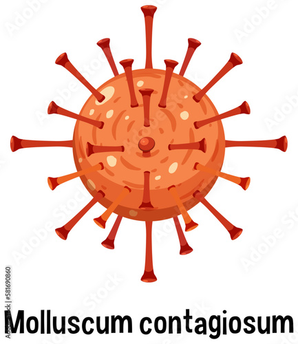 Molluscum contagiosum with text photo