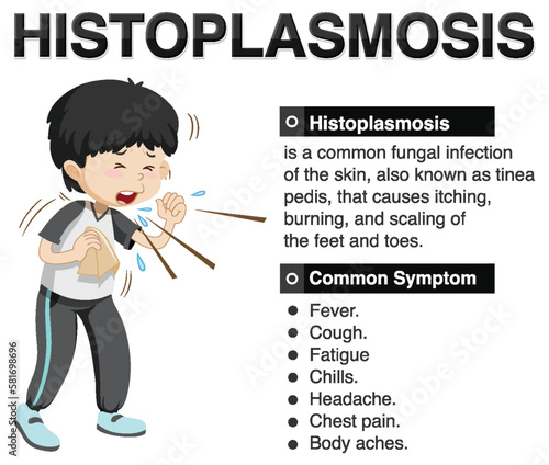 Informative poster of Histoplasmosis