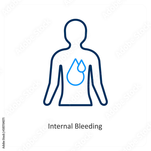 internal bleeding