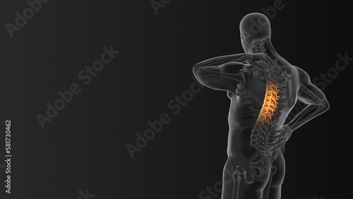 Cervical vertebral pain medical animation photo