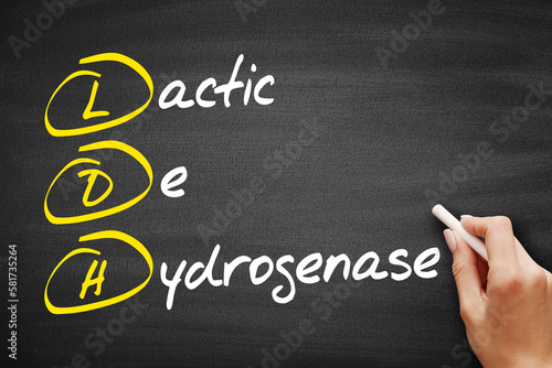 LDH - lactic dehydrogenase acronym, concept on blackboard photo