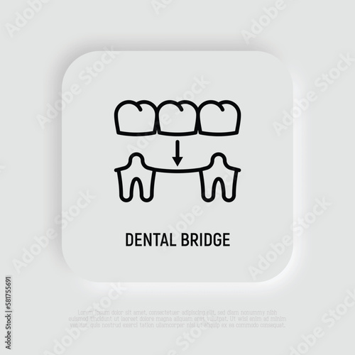 Dental bridge thin line icon. Dentistry, prosthesis. Tooth restoration. Vector illustration.