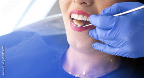 dentist with a mirror checking teeth