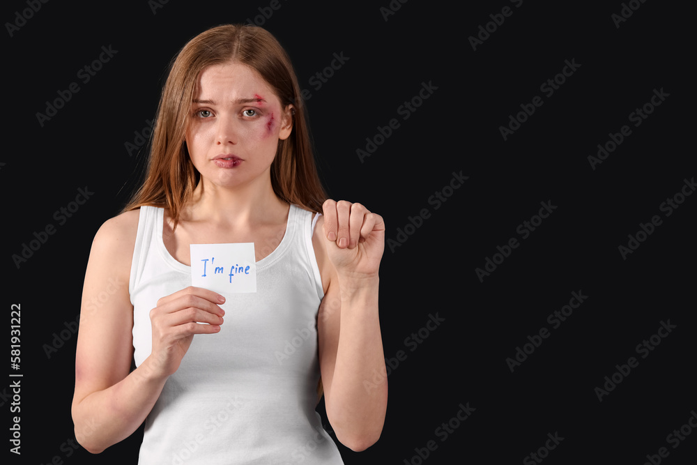 Bruised young woman holding paper with text I'M FINE on dark background. Domestic violence concept Bruised young woman holding paper with text I'M FINE on dark background. Domestic violence concept
