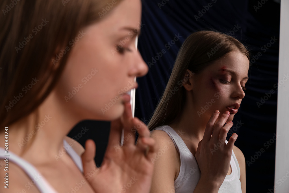 Bruised young woman near mirror on dark background, closeup. Domestic violence concept Bruised young woman near mirror on dark background, closeup. Domestic violence concept