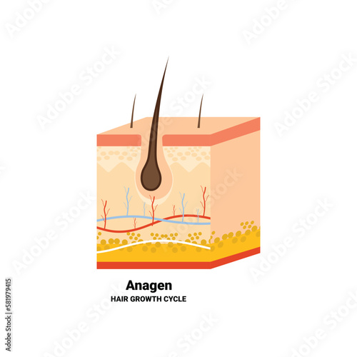 Hair follicle in anagen phase shown in skin cross-section. Hair growth cycle medical educational poster. Removal, treatment and transplantation concept. Vector illustration.