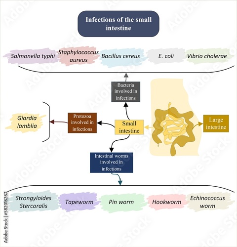 Infections of the small intestine photo