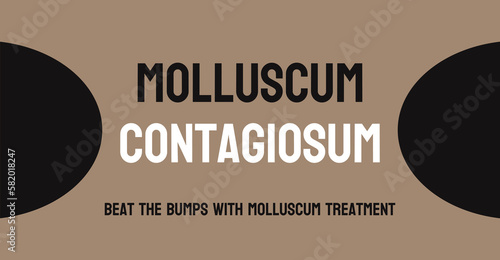 Molluscum Contagiosum - Viral skin infection characterized by small bumps. photo
