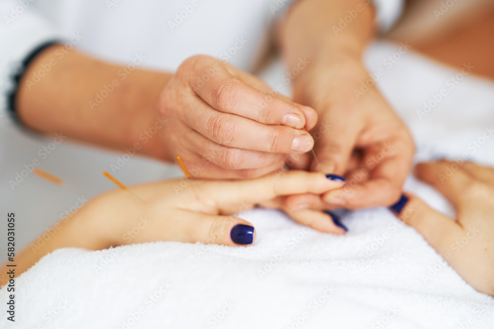 A acupuncture needle therapy in the studio A acupuncture needle therapy in the studio