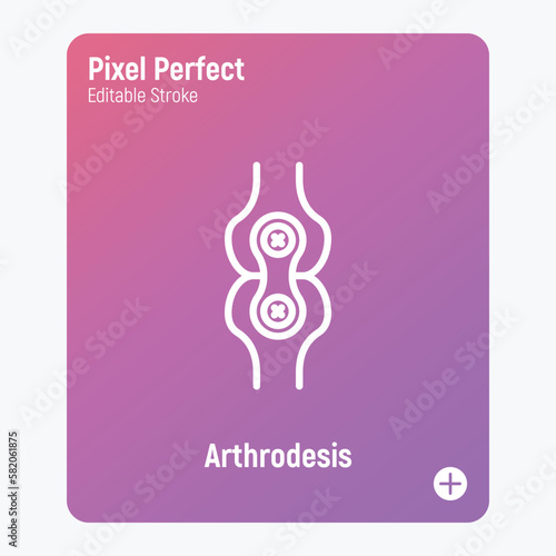 Arthrodesis joint surgery thin line icon. Arthritis. Pixel perfect, editable stroke. Vector illustration.