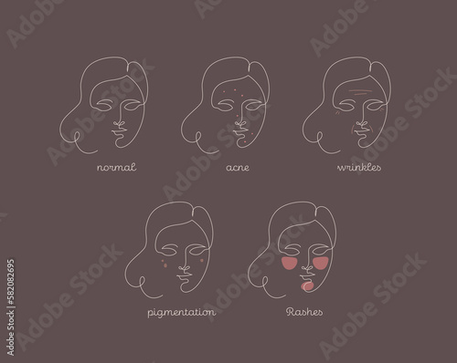 Skin type infographic. Vector one line modern illustration set. Female face avatar with acne, wrinkles. pigmentation, rashes problem color symbol on brown. Design for skincare, healthcare