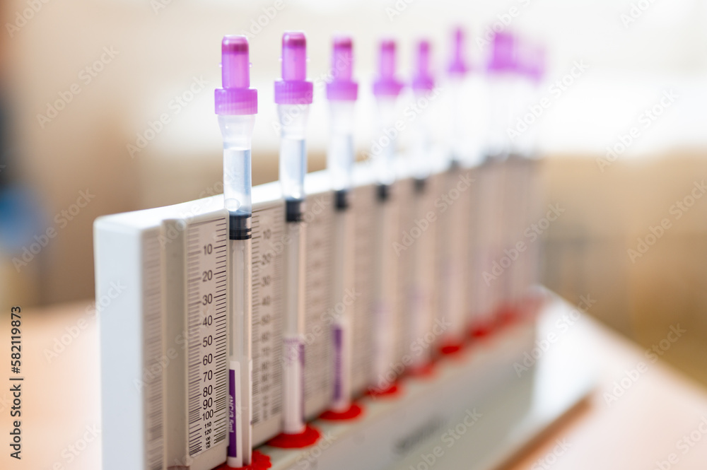 Blood collection tubes. Patients' blood ready for analysis in the