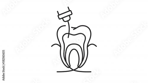 Animated endodontics linear icon. Dental pulp treatment. Obturation. Dentistry. Root canal. Seamless loop HD video with alpha channel on transparent background. Outline motion graphic animation photo