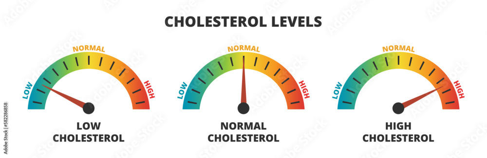 Vector infographic set of cholesterol levels – cholesterol meters with low, normal, and high level results. Indicator gauge with color scale and arrow showing cholesterol levels isolated on white. Vector infographic set of cholesterol levels – cholesterol meters with low, normal, and high level results. Indicator gauge with color scale and arrow showing cholesterol levels isolated on white.