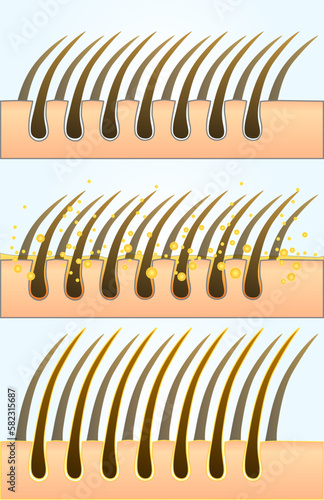 Medical illustration, hair scheme