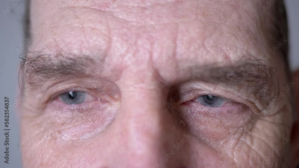 Blue Sad Eyes of an Old Man with Deep Wrinkles, Poor Eyesight, Pensive Look. Close up. Elderly pensioner blinking looking at a light. Loss vision. Cataracts, clouding of lens. Aging. Face. Memories. Blue Sad Eyes of an Old Man with Deep Wrinkles, Poor Eyesight, Pensive Look. Close up. Elderly pensioner blinking looking at a light. Loss vision. Cataracts, clouding of lens. Aging. Face. Memories.