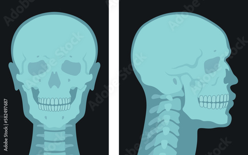 X rays shots of human skull front side view set vector flat illustration. Skeleton bone roentgen