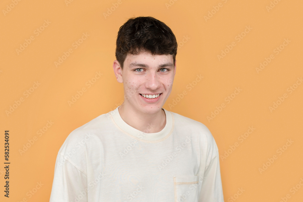 A young teenage boy has pimples and black dots on his face, but he is not shy and smiles sincerely, his friends accept him as he is. A guy with problem skin has acne A young teenage boy has pimples and black dots on his face, but he is not shy and smiles sincerely, his friends accept him as he is. A guy with problem skin has acne
