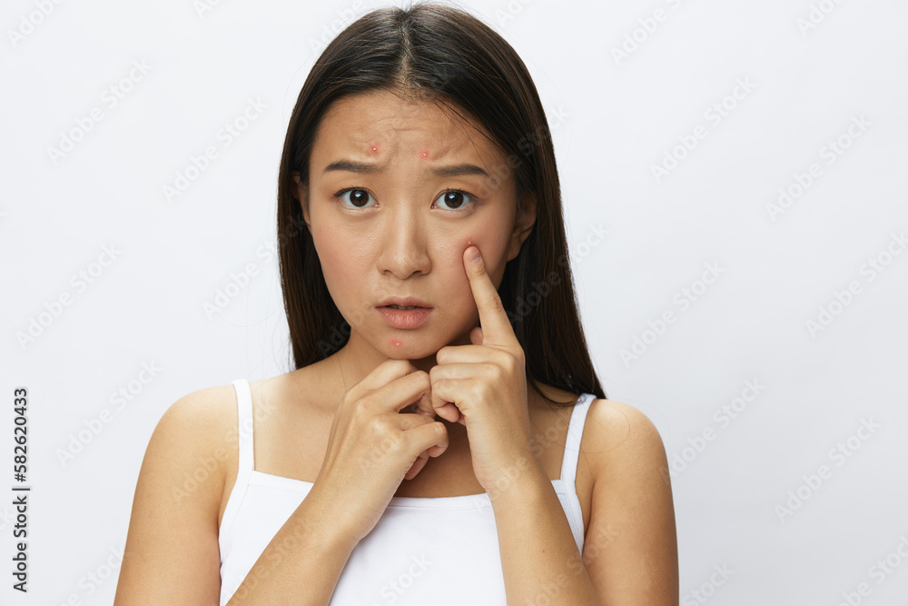 Asian woman facial skin problems, acne and inflammation, red rashes and allergies, chicken pox, sadness from rashes. Facial skin care concept for diseases and nerves Asian woman facial skin problems, acne and inflammation, red rashes and allergies, chicken pox, sadness from rashes. Facial skin care concept for diseases and nerves