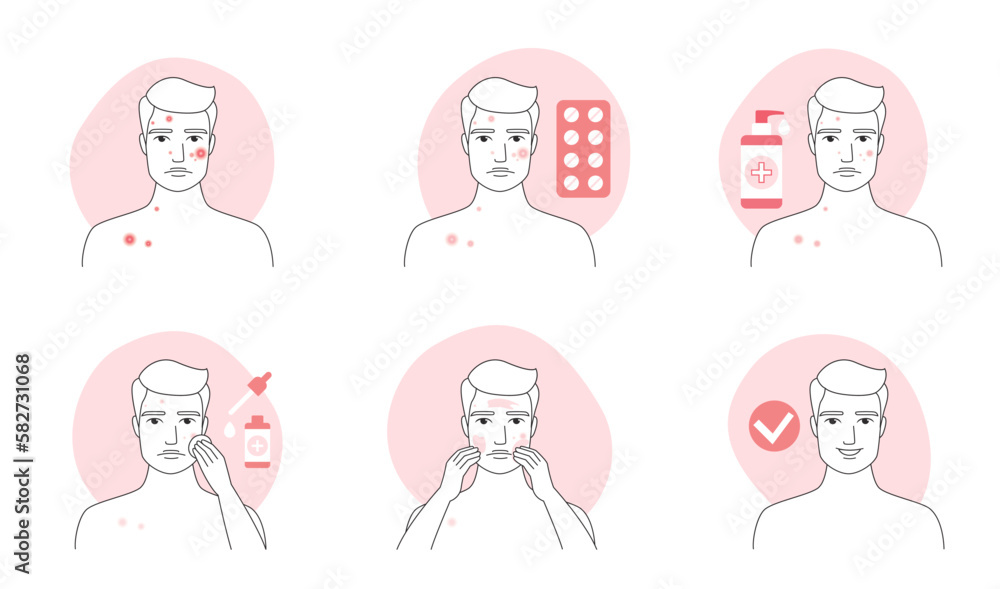 Acne treatment for man infographic line icon set vector illustration. Hand drawn outline guys treat rash of pimples with pills, puberty facial problem, apply skincare liquid products, ointment on skin Acne treatment for man infographic line icon set vector illustration. Hand drawn outline guys treat rash of pimples with pills, puberty facial problem, apply skincare liquid products, ointment on skin